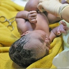 Los bebés que nacen de menos de 2,5 kilos pueden tener serios problemas de salud Meutia Chaerani - Indradi Soemardjan/Wikipedia