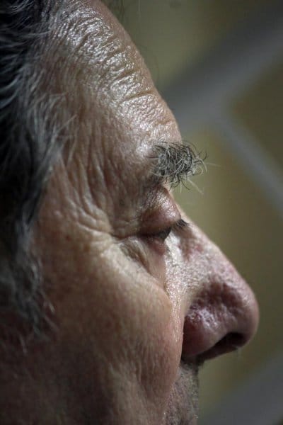 Ojo hombre. Demencia. Soledad