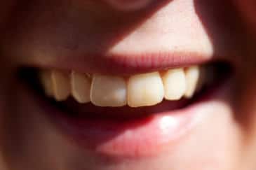 La sonrisa domina gran parte de las etapas iniciales del procesamiento cerebral de las caras. / HÁ¥kan DahlstrÁ¶m