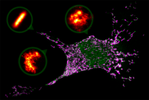 Imagen de microscopía confocal donde se observa una célula de mamífero entrando en apoptosis o suicidio celular. Las mitocondrias se muestran en magenta y la proteína Bax en verde, organizada en zonas donde las mitocondrias se están fragmentando. Los detalles o zooms son estructuras de Bax (en naranja) captadas por microscopía de superresolución en forma de anillos, arcos y líneas. / R. Salvador-Gallego